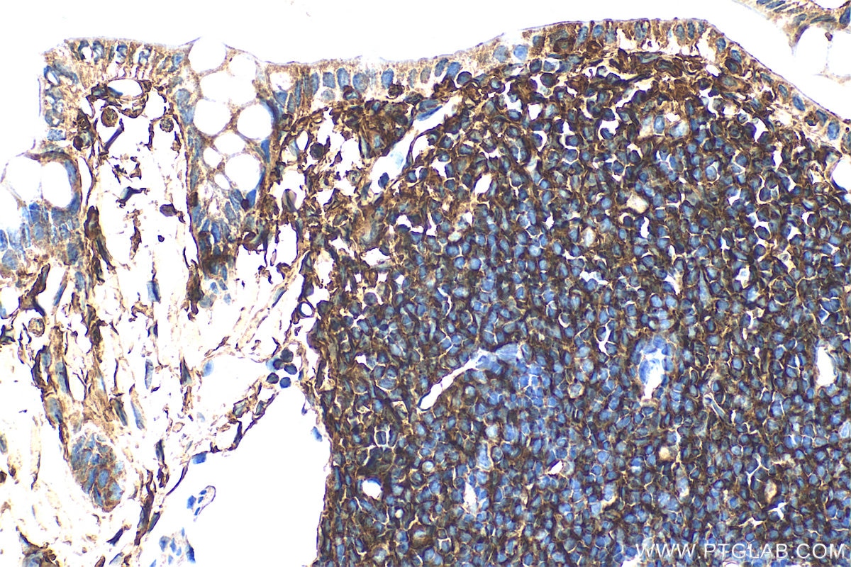 Immunohistochemistry (IHC) staining of mouse colon tissue using CD44 Polyclonal antibody (30854-1-AP)