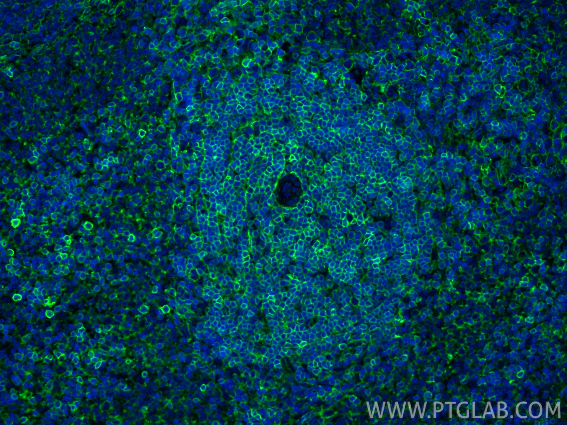 Immunofluorescent analysis of (4% PFA) fixed paraffin-embedded rat spleen tissue using CD44 antibody (31981-1-AP) at dilution of 1:200 and CoraLite®488-Conjugated Goat Anti-Rabbit IgG(H+L) (SA00013-2). Heat mediated antigen retrieval with Tris-EDTA buffer (pH 9.0). Immunofluorescence (IF) / fluorescent staining of rat spleen tissue using CD44 Polyclonal antibody (31981-1-AP)