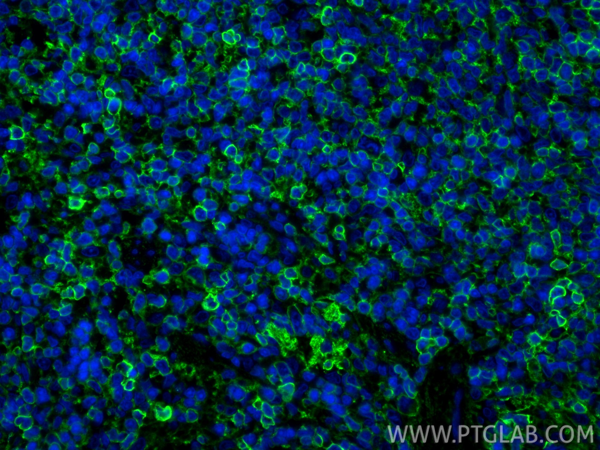 Immunofluorescent analysis of (4% PFA) fixed paraffin-embedded rat spleen tissue using CD44 antibody (31981-1-AP) at dilution of 1:200 and CoraLite®488-Conjugated Goat Anti-Rabbit IgG(H+L) (SA00013-2). Heat mediated antigen retrieval with Tris-EDTA buffer (pH 9.0). Immunofluorescence (IF) / fluorescent staining of rat spleen tissue using CD44 Polyclonal antibody (31981-1-AP)