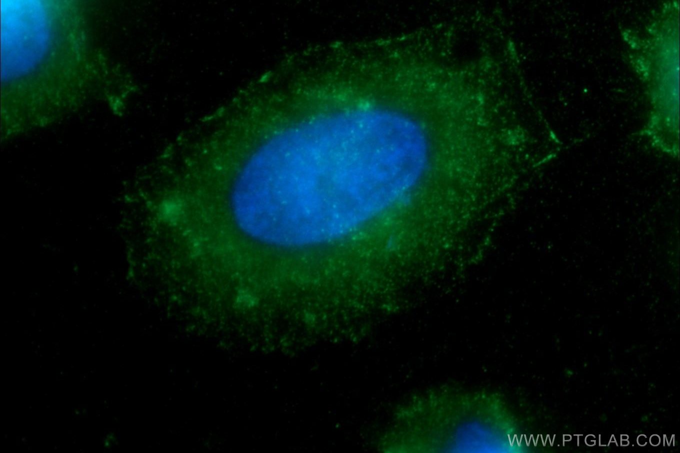 CD44 Monoclonal antibody