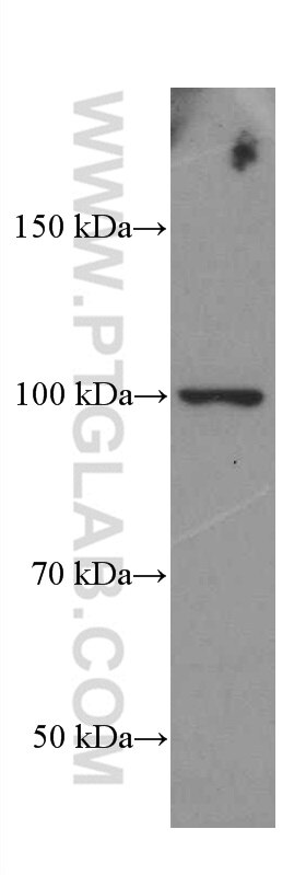 Western Blot (WB) analysis of HUVEC cells using CD44 Monoclonal antibody (60224-1-Ig)