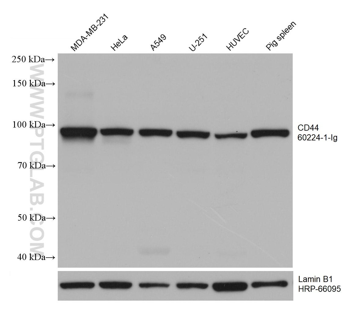 Western Blot (WB) analysis of various lysates using CD44 Monoclonal antibody (60224-1-Ig)