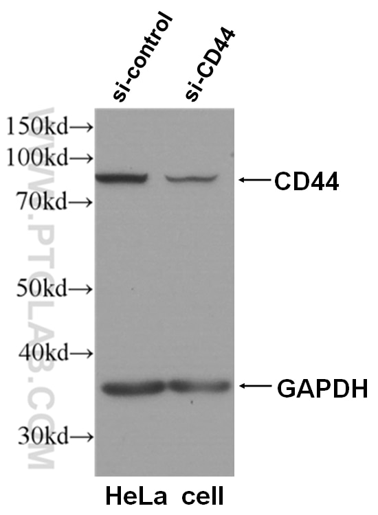 Western Blot (WB) analysis of HeLa cells using CD44 Monoclonal antibody (60224-1-Ig)