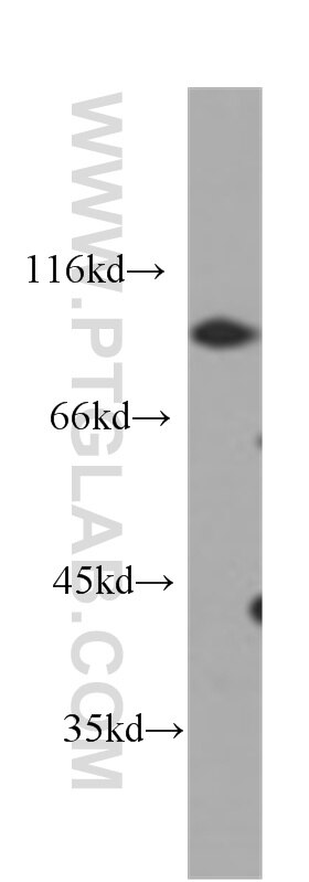 Western Blot (WB) analysis of HeLa cells using CD44 Monoclonal antibody (60224-1-Ig)