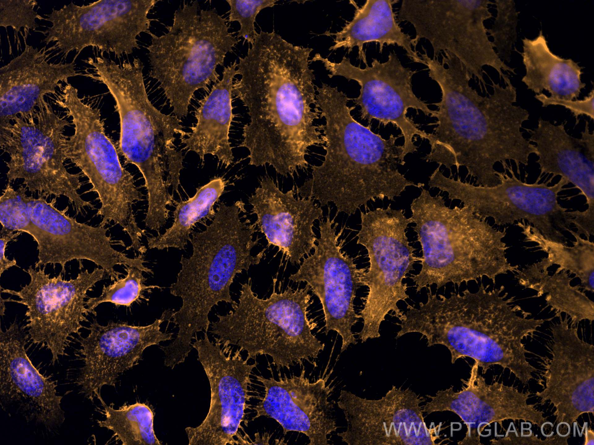 Immunofluorescence (IF) / fluorescent staining of HeLa cells using Anti-Mouse CD44 (IM7) (65117-1-Ig)