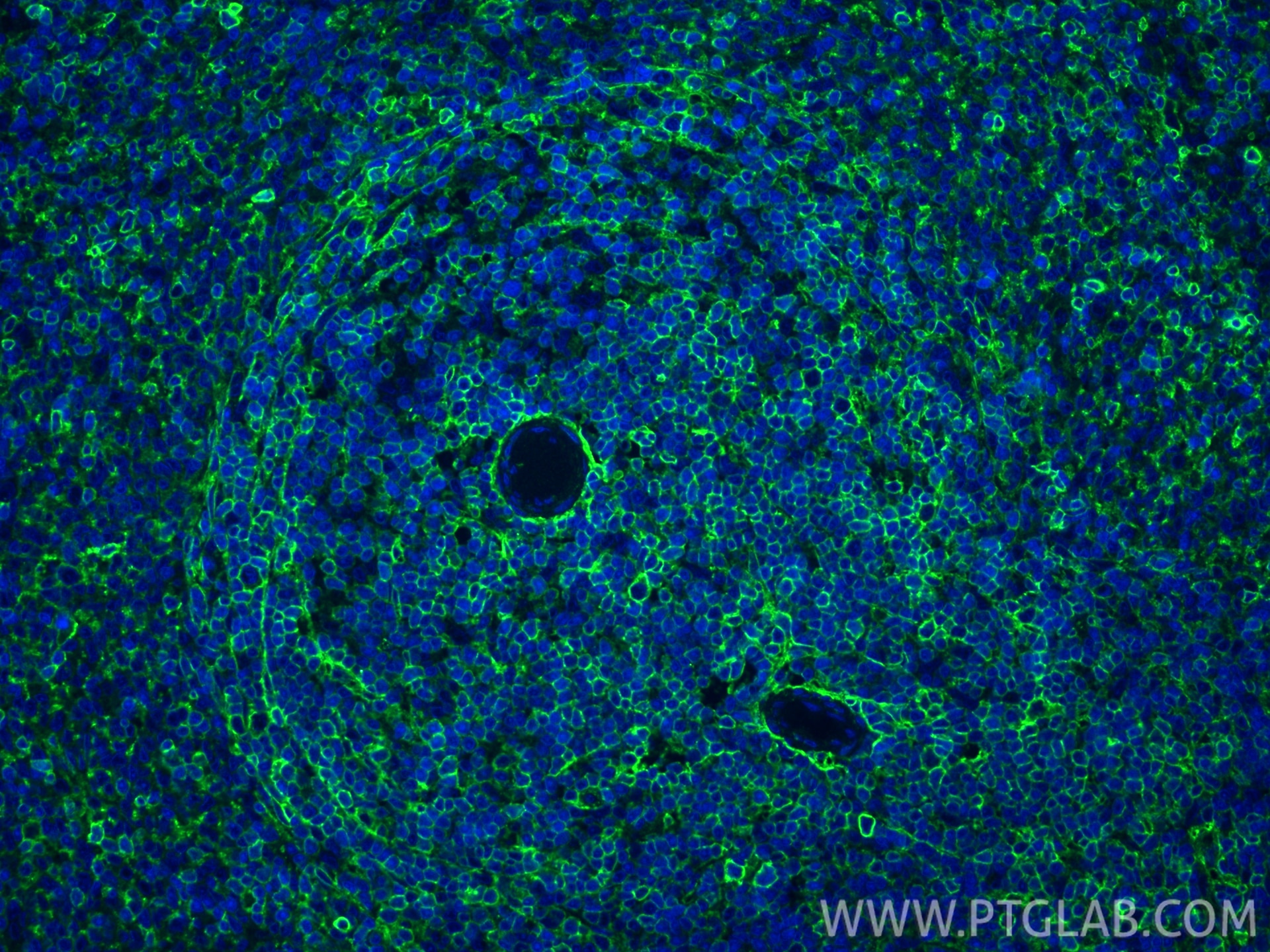 Immunofluorescence (IF) / fluorescent staining of rat spleen tissue using CD44 Recombinant monoclonal antibody (84369-5-RR)