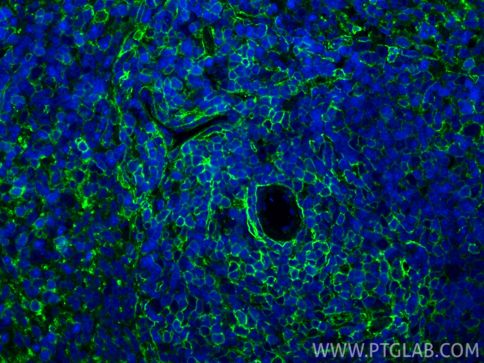 Immunofluorescence (IF) / fluorescent staining of rat spleen tissue using CD44 Recombinant monoclonal antibody (84369-5-RR)
