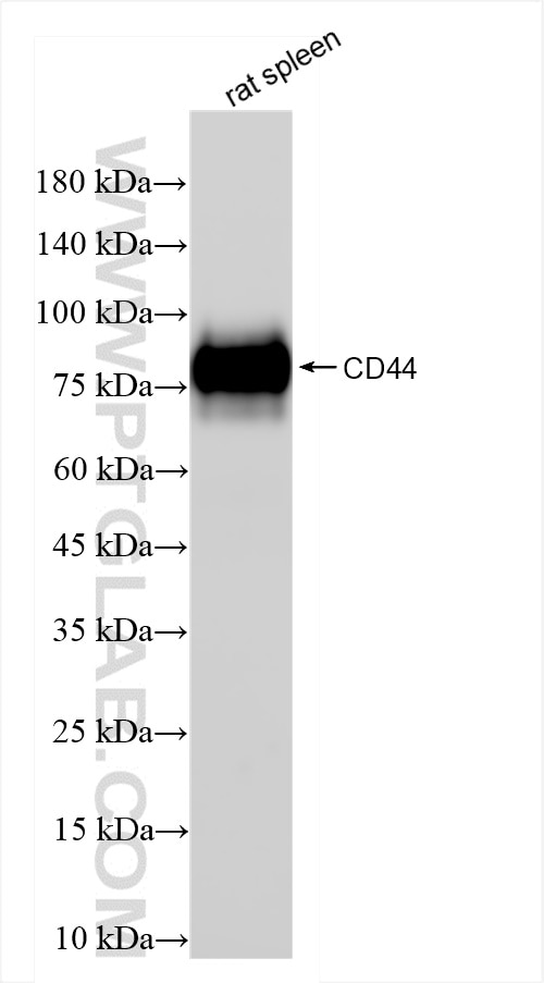 Western Blot (WB) analysis of rat spleen tissue using CD44 Recombinant antibody (84369-5-RR)
