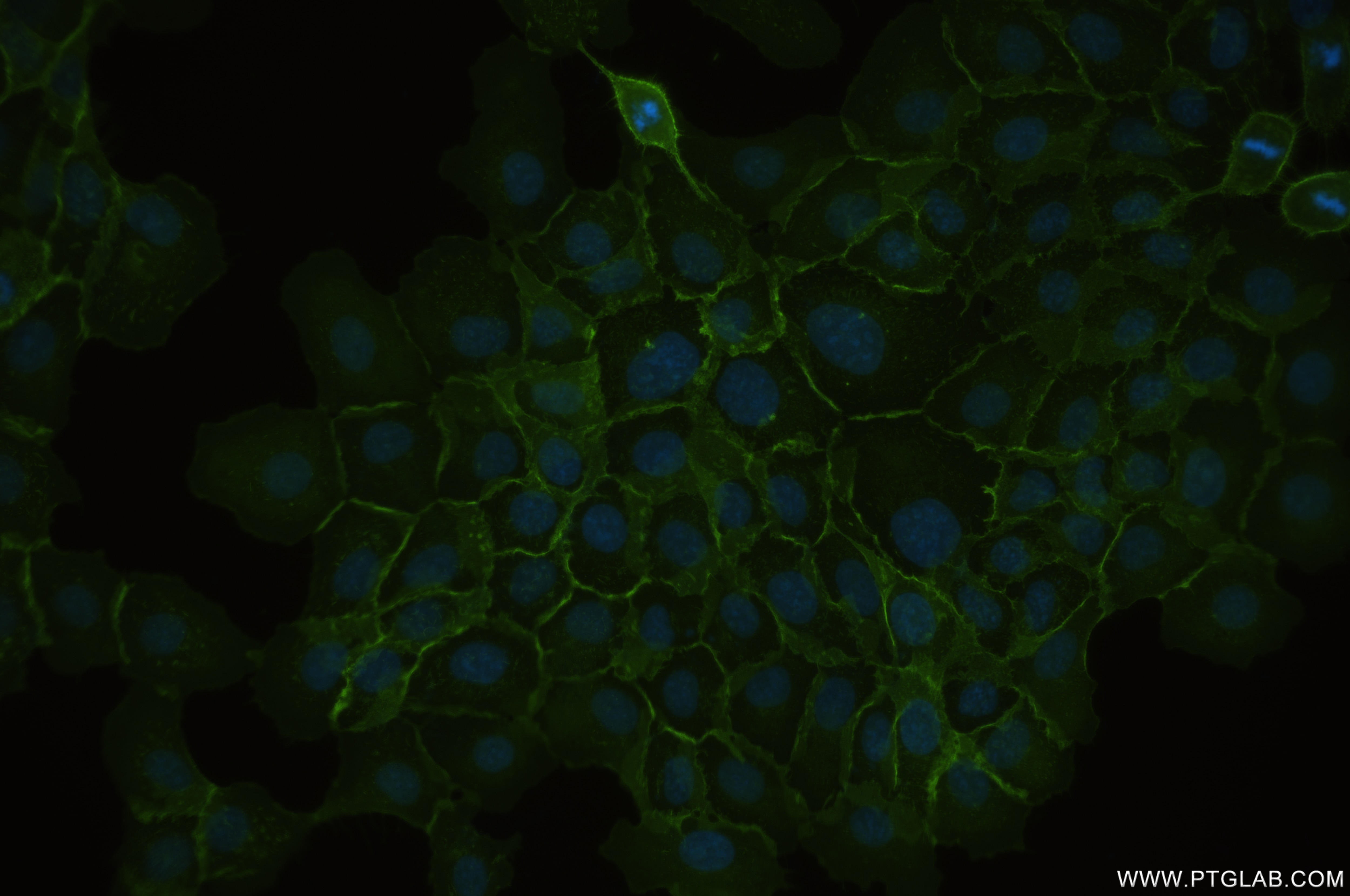 Immunofluorescence (IF) / fluorescent staining of A431 cells using CD44 Recombinant antibody (84854-5-RR)