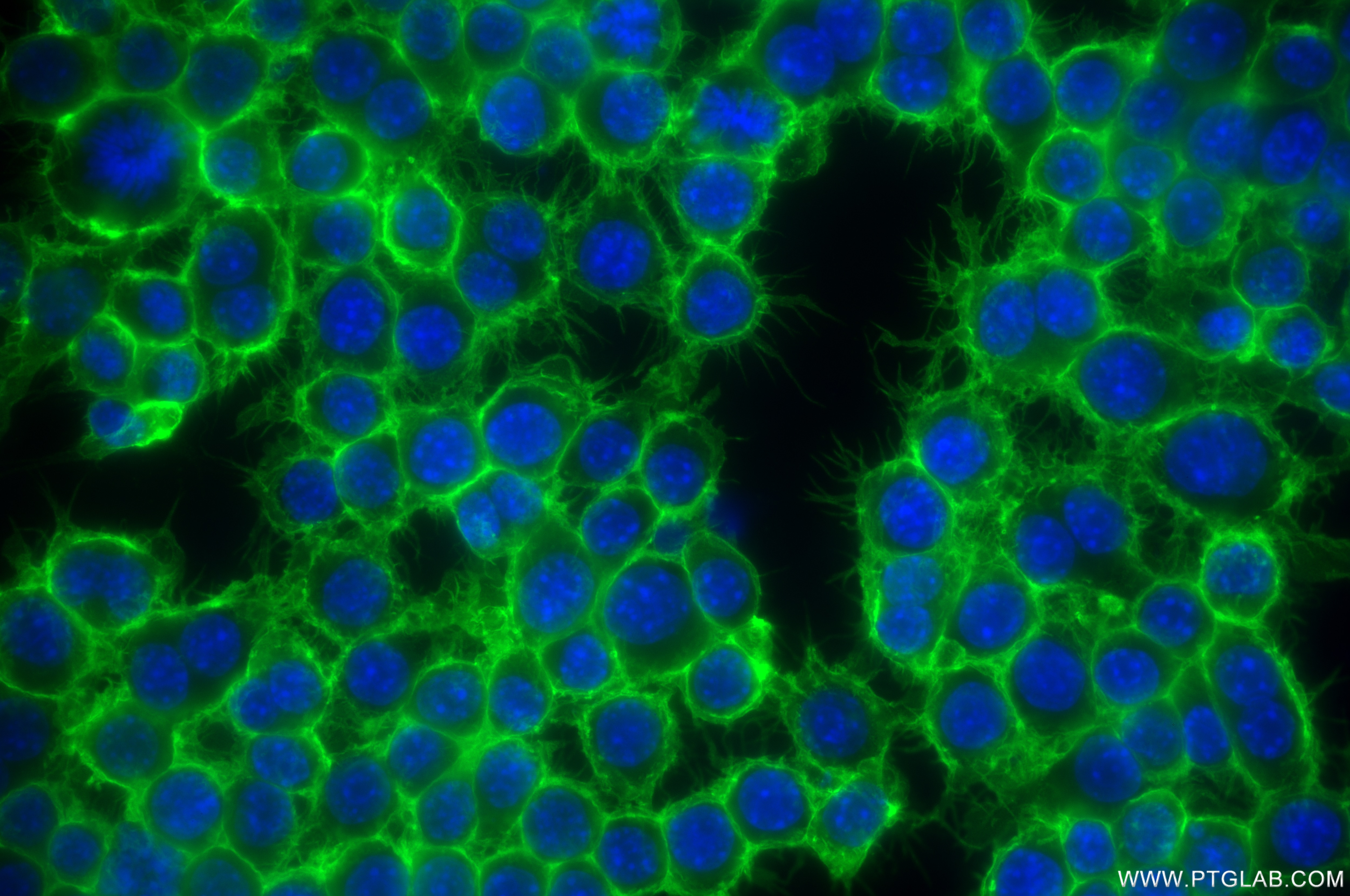 Immunofluorescence (IF) / fluorescent staining of RAW 264.7 cells using CD44 Recombinant antibody (85163-5-RR)
