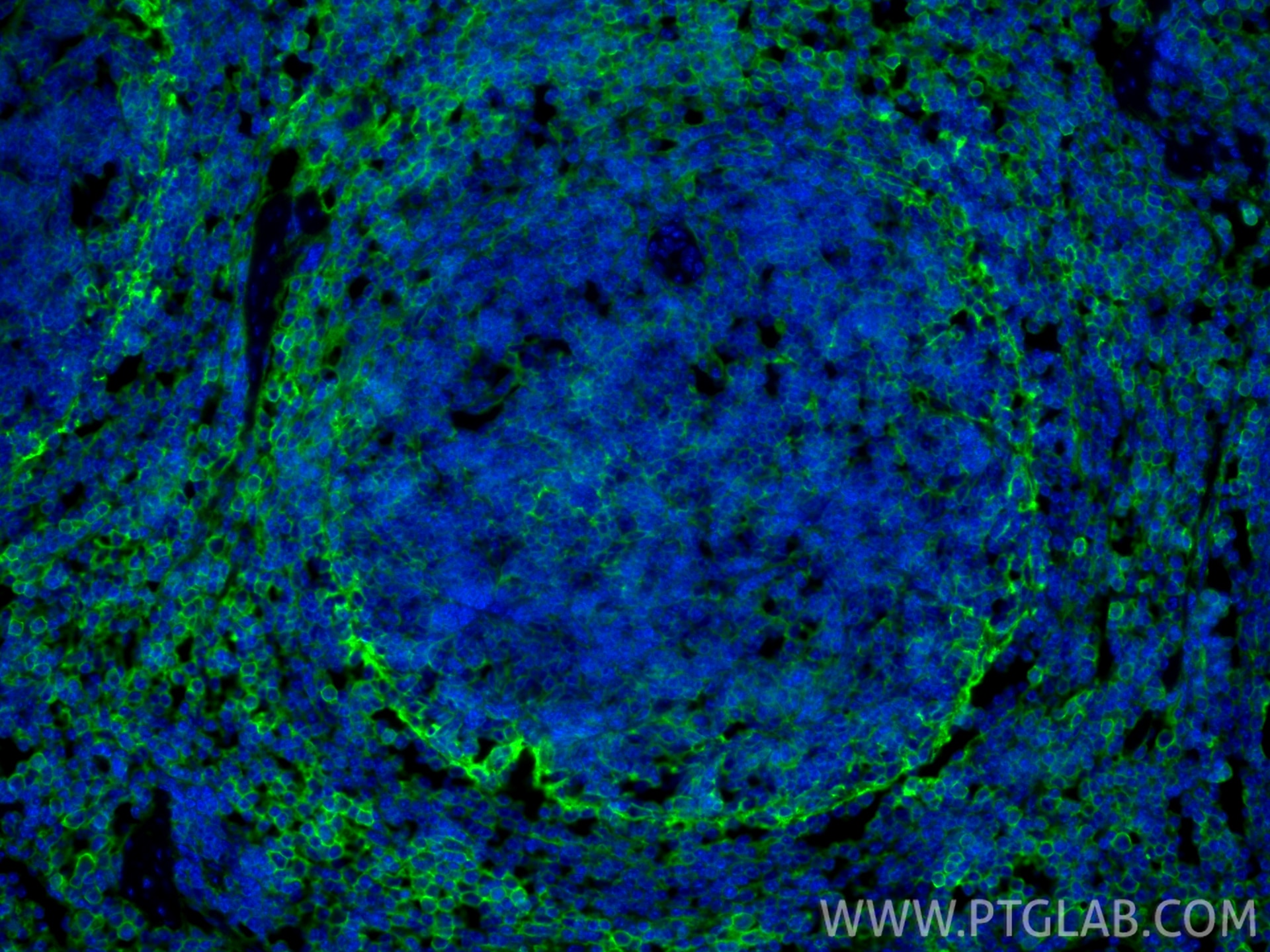 IF Staining of mouse spleen using 85163-5-RR Immunofluorescence (IF) / fluorescent staining of mouse spleen tissue using CD44 Recombinant monoclonal antibody (85163-5-RR)