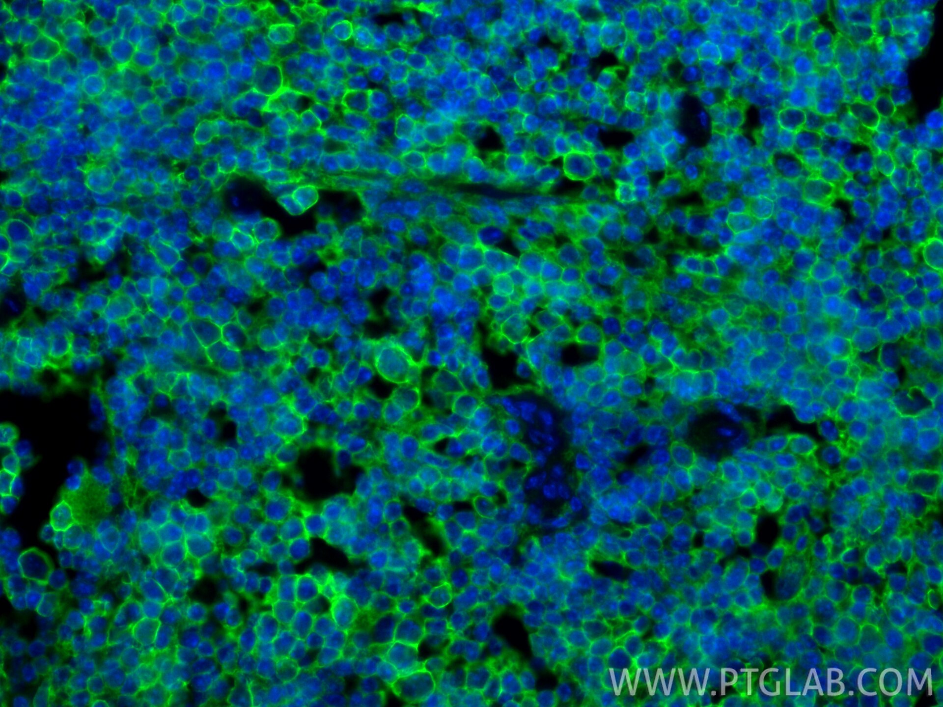 Immunofluorescence (IF) / fluorescent staining of mouse spleen tissue using CD44 Recombinant monoclonal antibody (85163-5-RR)