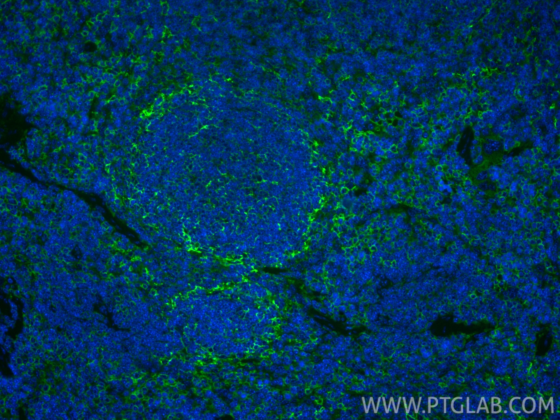 IF Staining of mouse spleen using 85163-5-RR Immunofluorescence (IF) / fluorescent staining of mouse spleen tissue using CD44 Recombinant monoclonal antibody (85163-5-RR)
