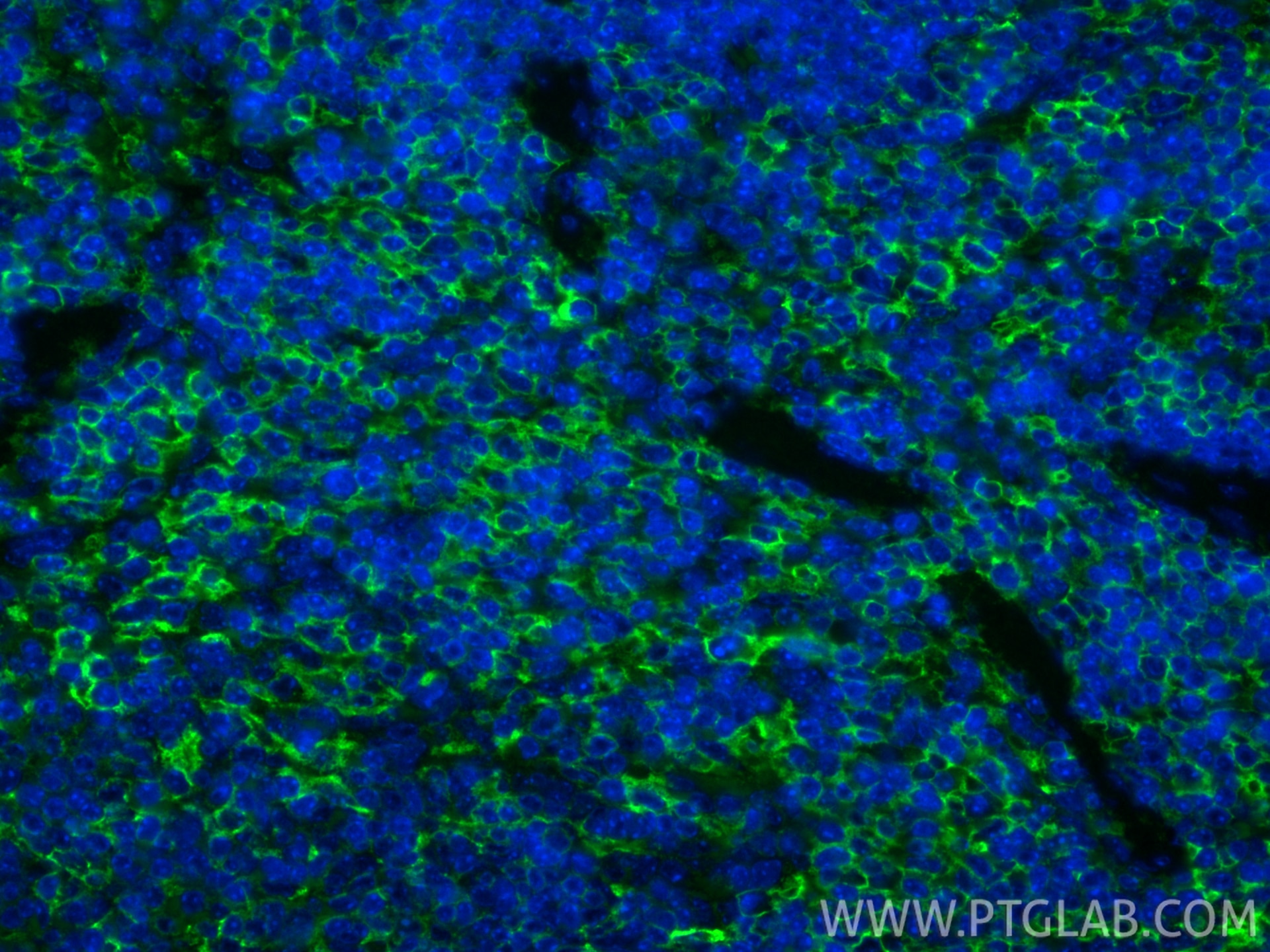 IF Staining of mouse spleen using 85163-5-RR (same clone as 85163-5-PBS) Immunofluorescence (IF) / fluorescent staining of mouse spleen tissue using CD44 Recombinant monoclonal antibody (85163-5-RR)