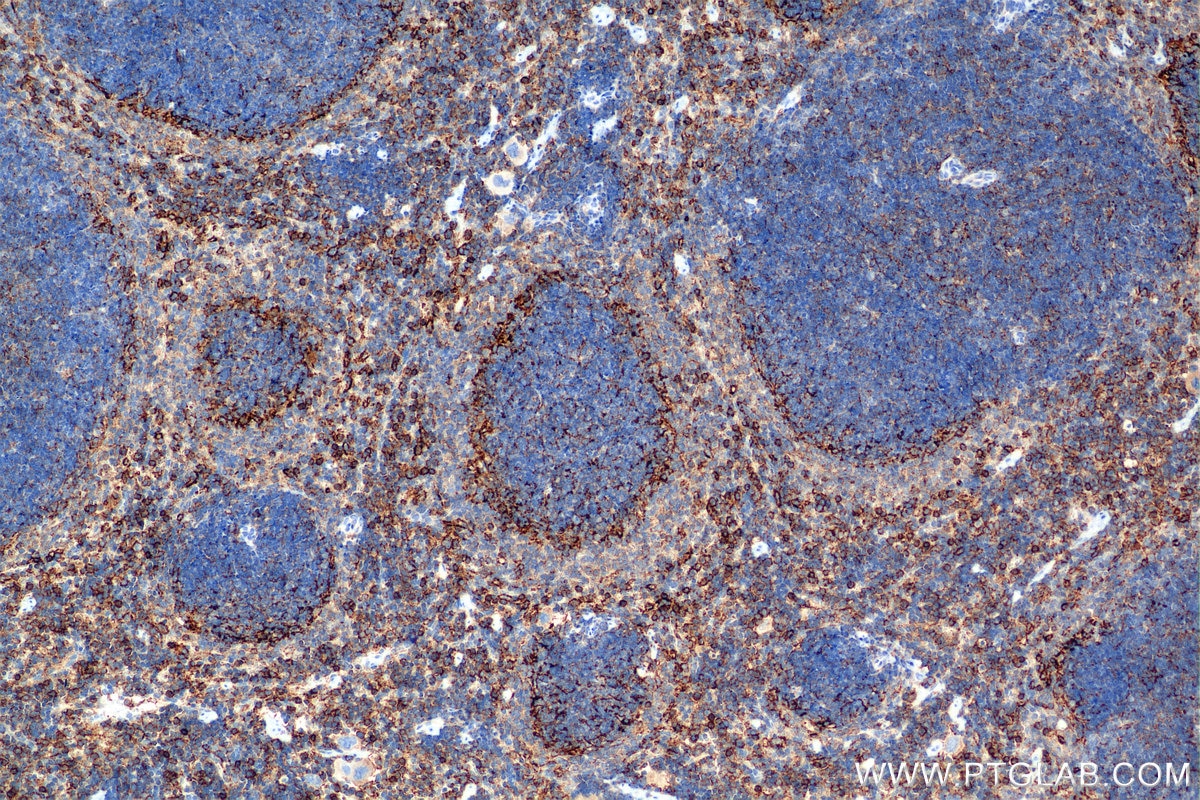 Immunohistochemical analysis of paraffin-embedded mouse spleen tissue slide using 85163-5-RR (CD44 antibody) at dilution of 1:2000 (under 10x lens). Heat mediated antigen retrieval with Tris-EDTA buffer (pH 9.0). This data was developed using the same antibody clone with 85163-5-PBS in a different storage buffer formulation. Immunohistochemistry (IHC) staining of mouse spleen tissue using CD44 Recombinant monoclonal antibody (85163-5-RR)