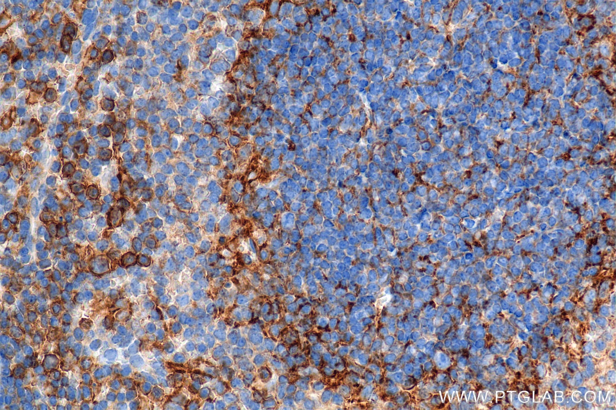 Immunohistochemical analysis of paraffin-embedded mouse spleen tissue slide using 85163-5-RR (CD44 antibody) at dilution of 1:2000 (under 40x lens). Heat mediated antigen retrieval with Tris-EDTA buffer (pH 9.0). This data was developed using the same antibody clone with 85163-5-PBS in a different storage buffer formulation. Immunohistochemistry (IHC) staining of mouse spleen tissue using CD44 Recombinant monoclonal antibody (85163-5-RR)