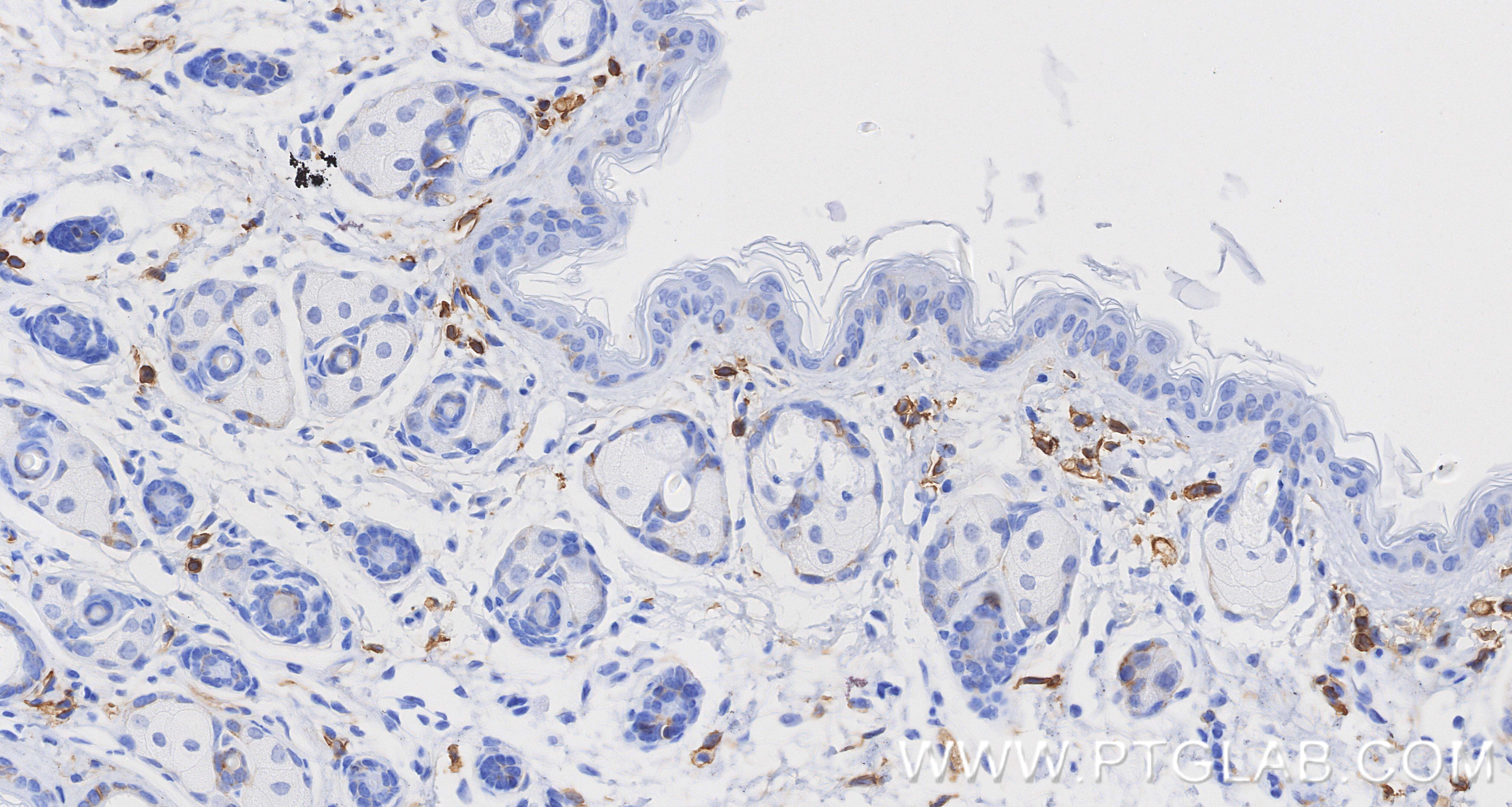 Immunohistochemical analysis of paraffin-embedded mouse skin tissue slide using 85163-5-RR (CD44 antibody) at dilution of 1:1000 (under 40x lens). Heat mediated antigen retrieval with Tris-EDTA buffer (pH 9.0). This data was developed using the same antibody clone with 85163-5-PBS in a different storage buffer formulation. Immunohistochemistry (IHC) staining of mouse skin tissue using CD44 Recombinant monoclonal antibody (85163-5-RR)