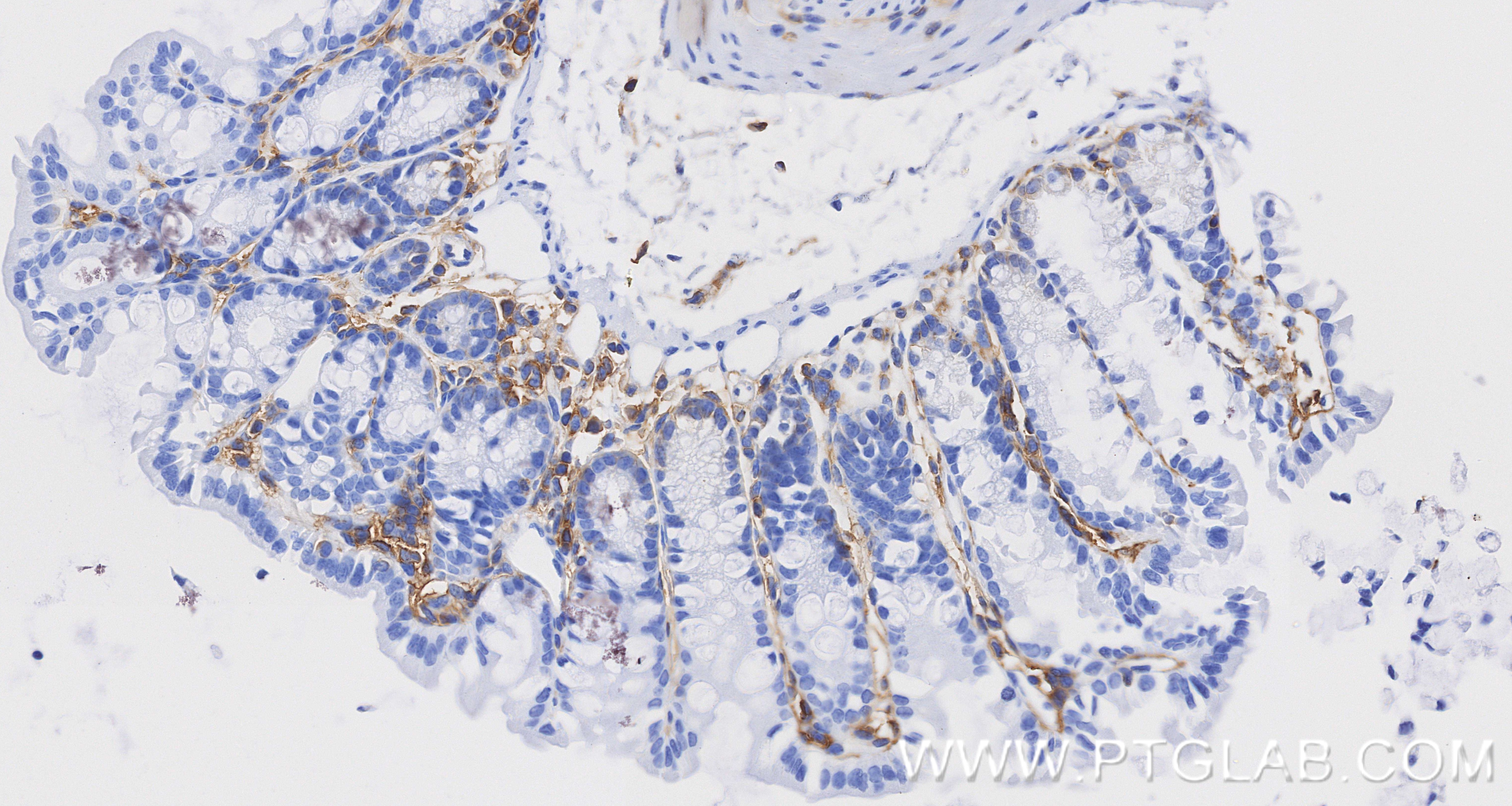 Immunohistochemical analysis of paraffin-embedded mouse colon tissue slide using 85163-5-RR (CD44 antibody) at dilution of 1:1000 (under 10x lens). Heat mediated antigen retrieval with Tris-EDTA buffer (pH 9.0). This data was developed using the same antibody clone with 85163-5-PBS in a different storage buffer formulation. Immunohistochemistry (IHC) staining of mouse colon tissue using CD44 Recombinant monoclonal antibody (85163-5-RR)