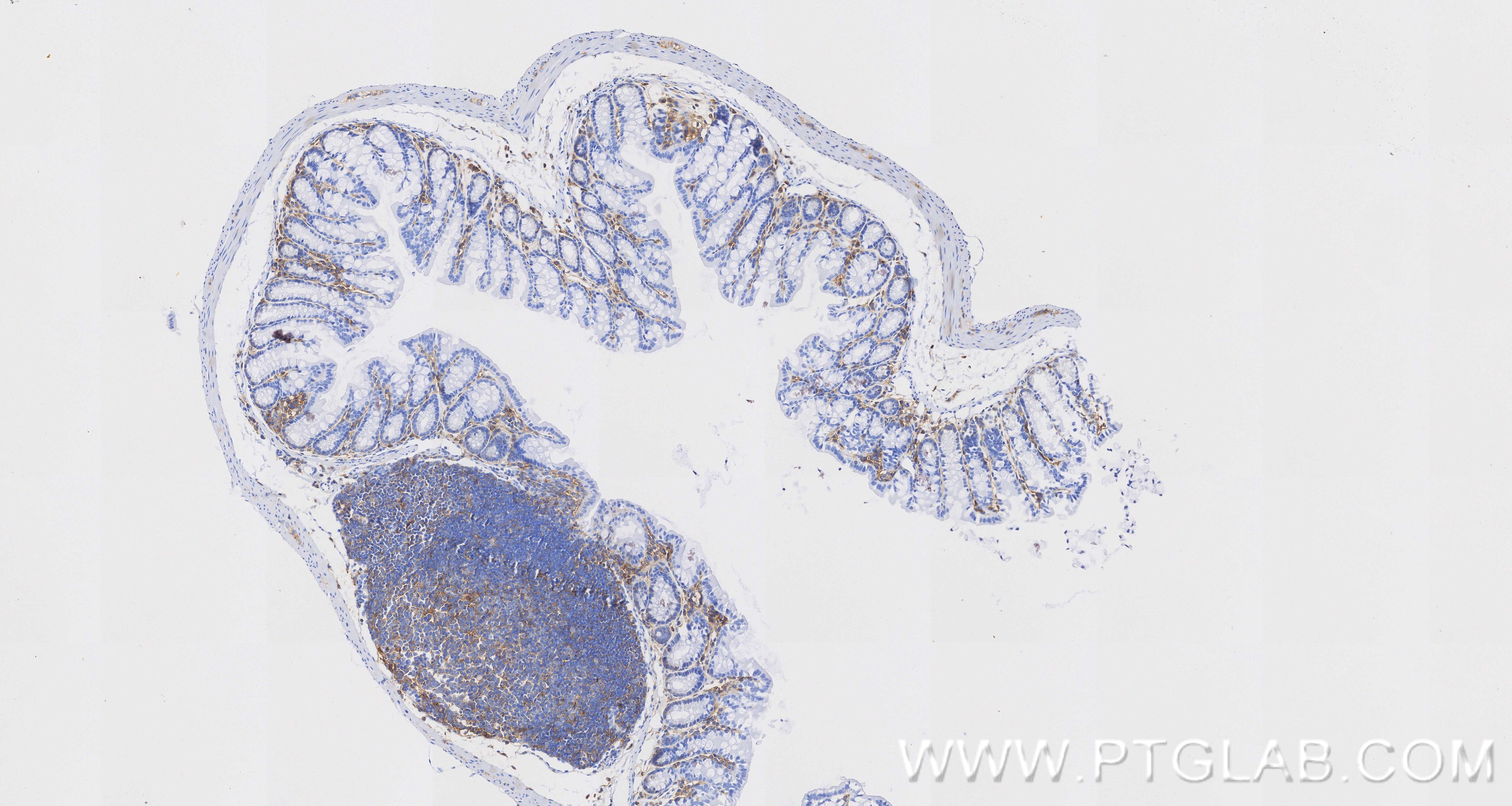 Immunohistochemical analysis of paraffin-embedded mouse colon tissue slide using 85163-5-RR (CD44 antibody) at dilution of 1:1000 (under 10x lens). Heat mediated antigen retrieval with Tris-EDTA buffer (pH 9.0). This data was developed using the same antibody clone with 85163-5-PBS in a different storage buffer formulation. Immunohistochemistry (IHC) staining of mouse colon tissue using CD44 Recombinant monoclonal antibody (85163-5-RR)