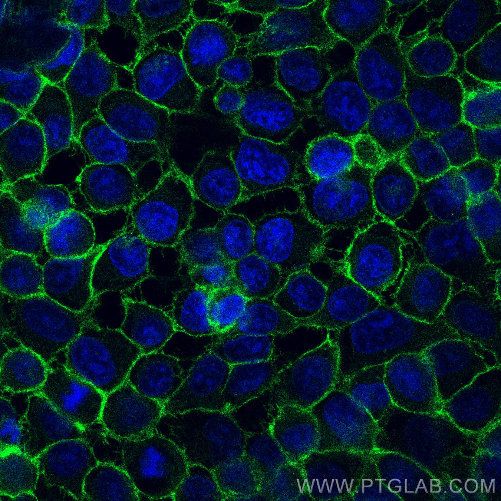 Immunofluorescence (IF) / fluorescent staining of HeLa cells using CoraLite® Plus 488-conjugated CD44 Polyclonal anti (CL488-15675)