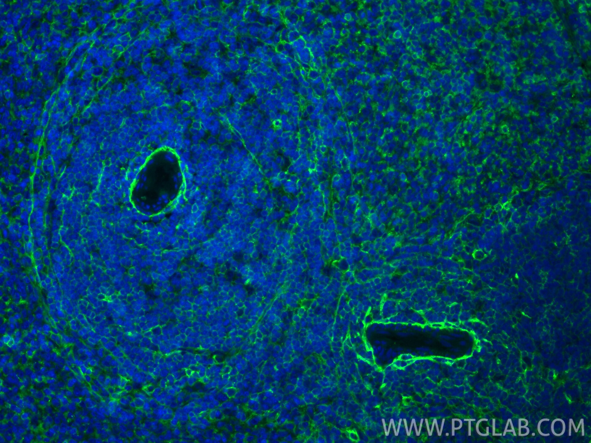 Immunofluorescence (IF) / fluorescent staining of rat spleen tissue using CoraLite® Plus 488-conjugated CD44 Recombinant mon (CL488-84369-5)