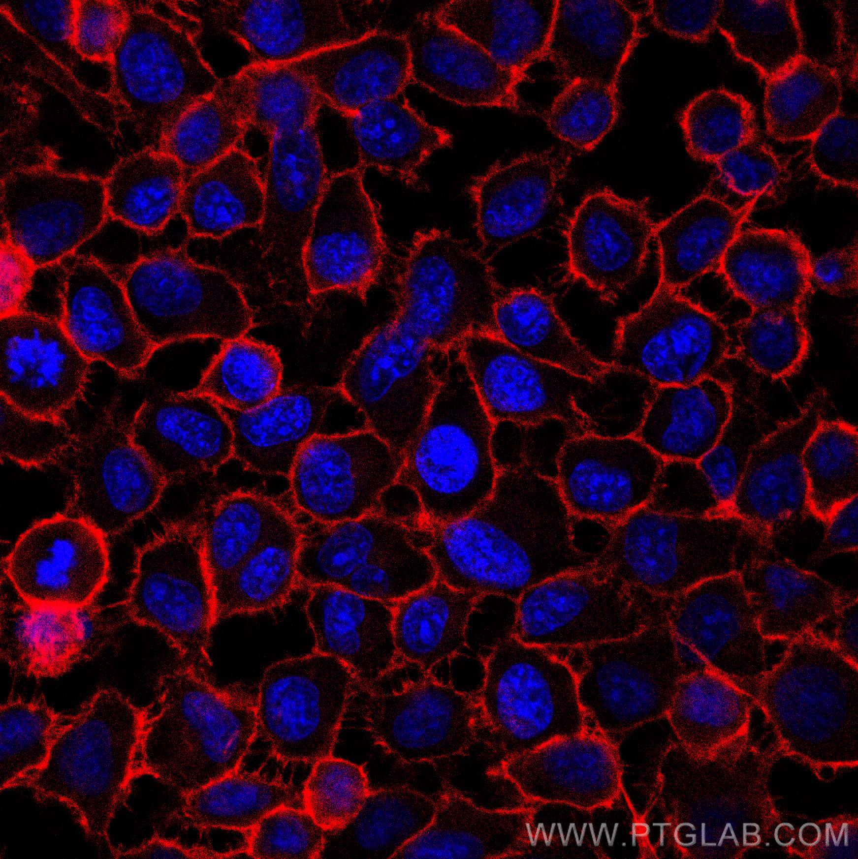 Immunofluorescence (IF) / fluorescent staining of HeLa cells using CoraLite®594-conjugated CD44 Polyclonal antibody (CL594-15675)