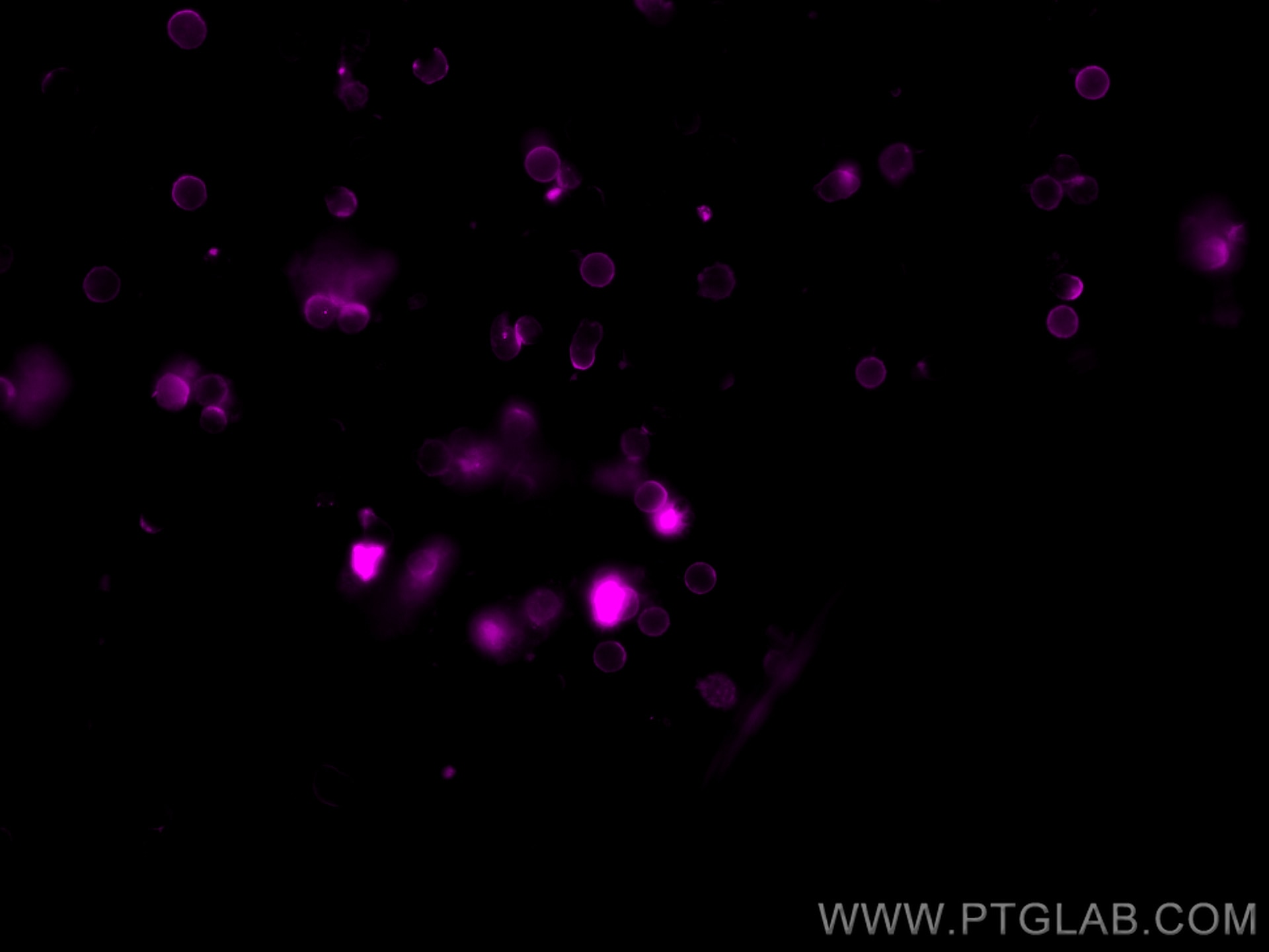 IF Staining of mouse splenocytes using CL647-65117