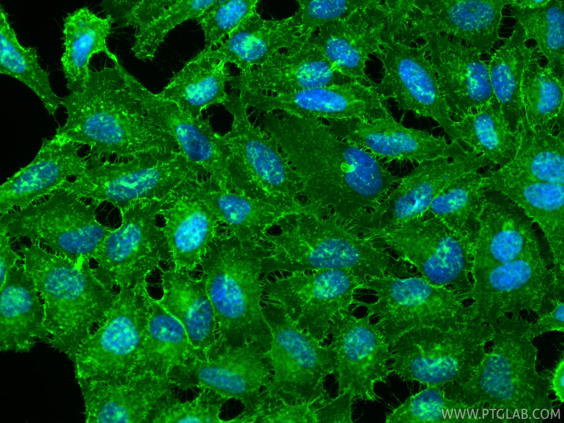 Immunofluorescence (IF) / fluorescent staining of HeLa cells using Multi-rAb® CD44 Multi-Recombinant antibody (RMX00065)