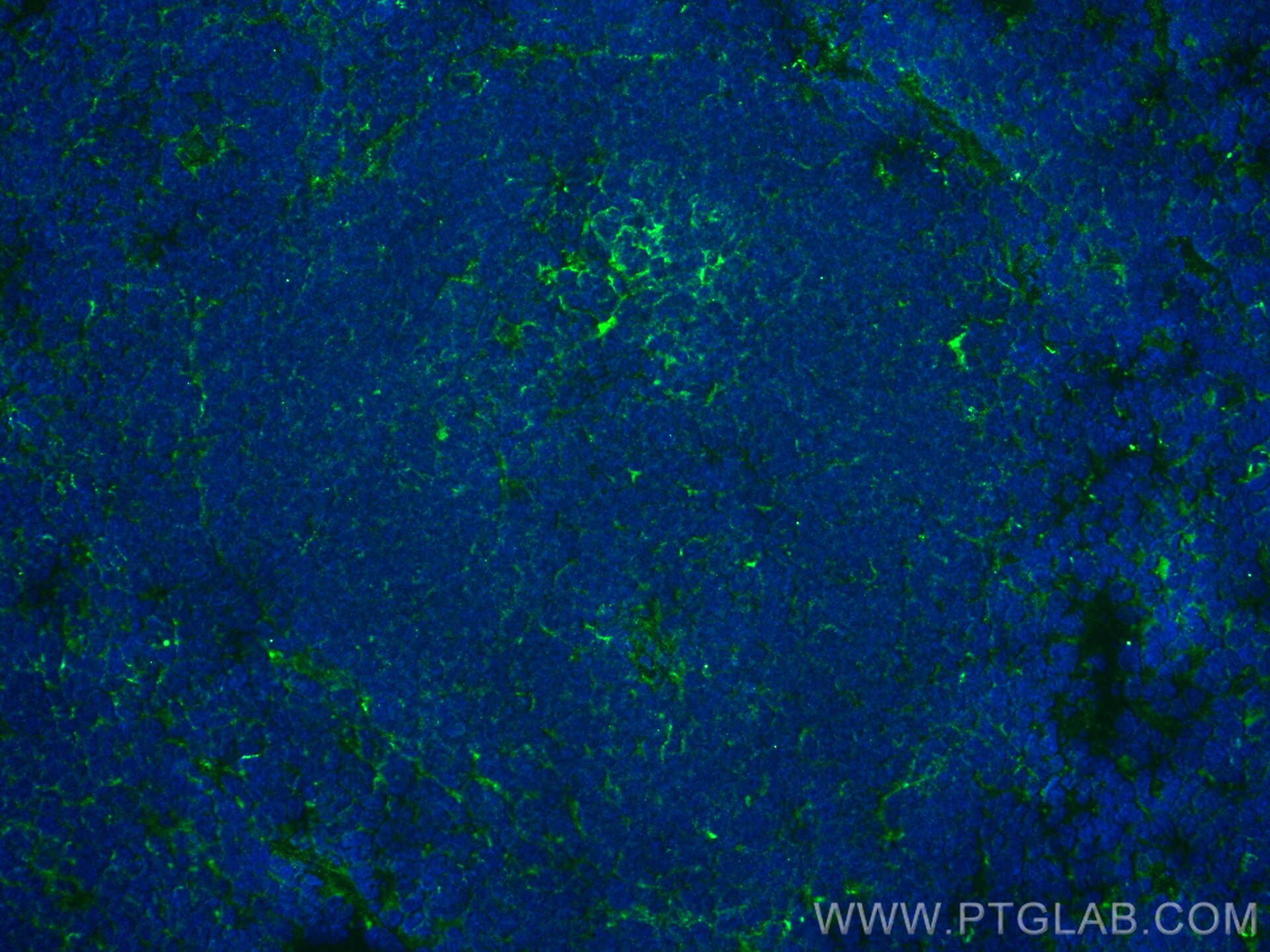 Immunofluorescence (IF) / fluorescent staining of mouse spleen tissue using CD45.1 Recombinant antibody (84325-2-RR)