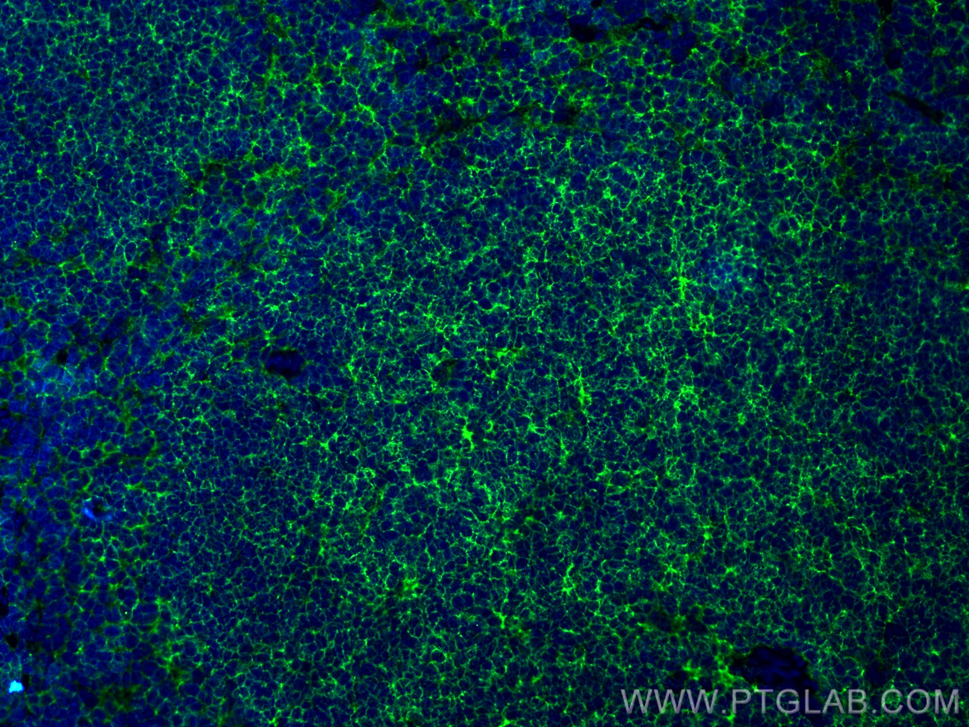 Immunofluorescence (IF) / fluorescent staining of mouse spleen tissue using CD45.2 Recombinant antibody (84637-1-RR)