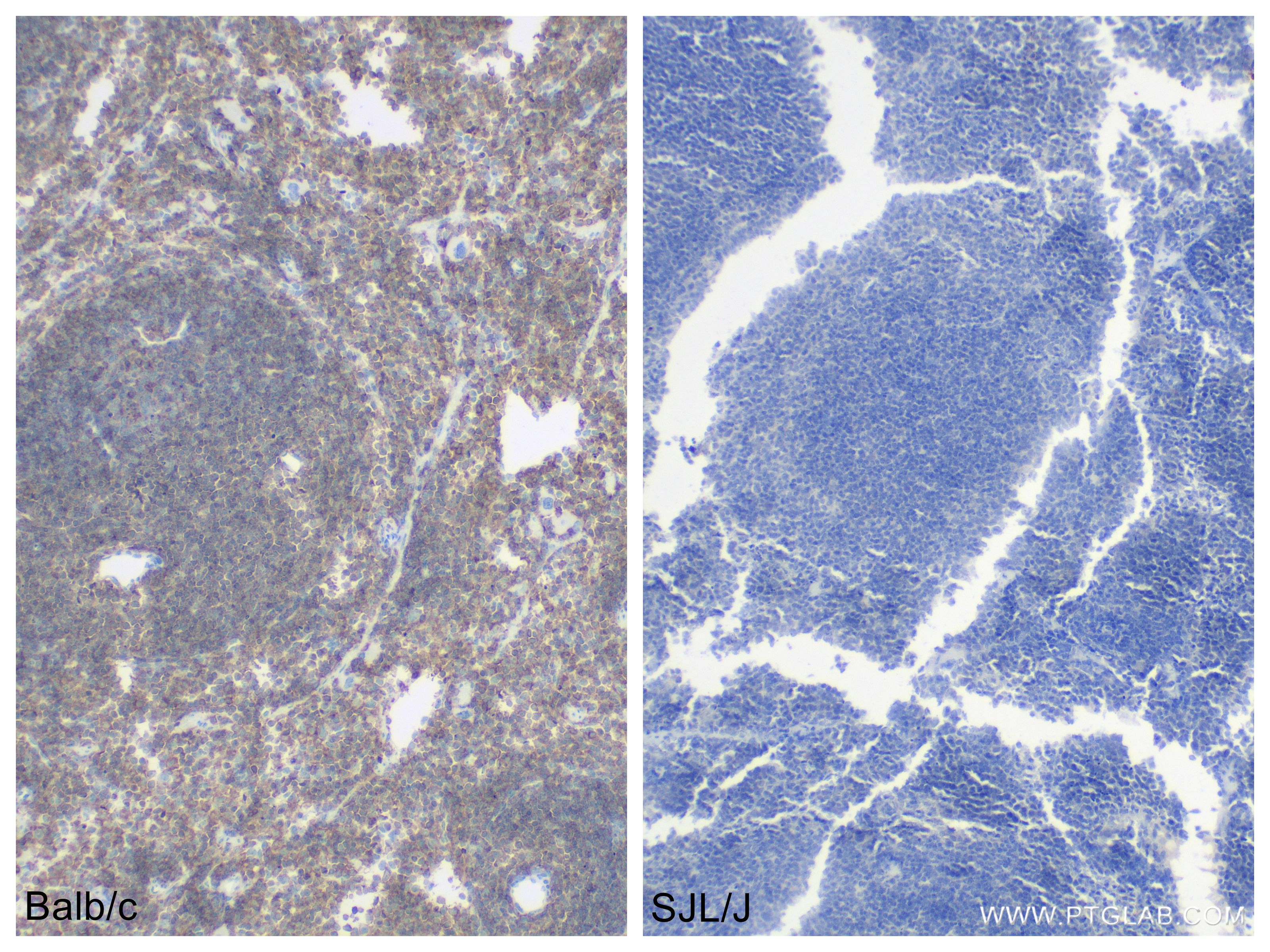 Immunohistochemistry (IHC) staining of mouse spleen tissue using CD45.2 Recombinant antibody (84637-1-RR)
