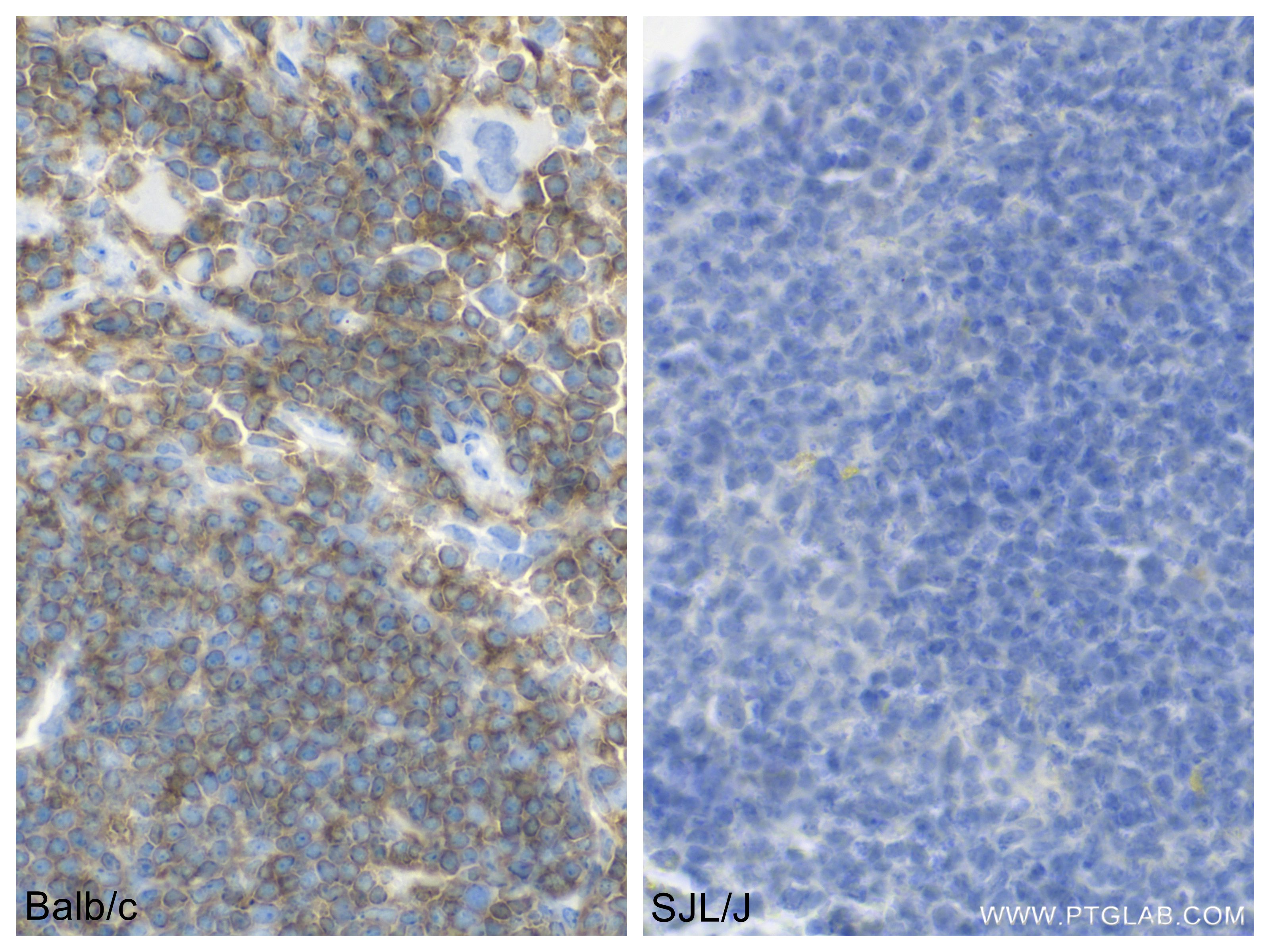 Immunohistochemistry (IHC) staining of mouse spleen tissue using CD45.2 Recombinant antibody (84637-1-RR)