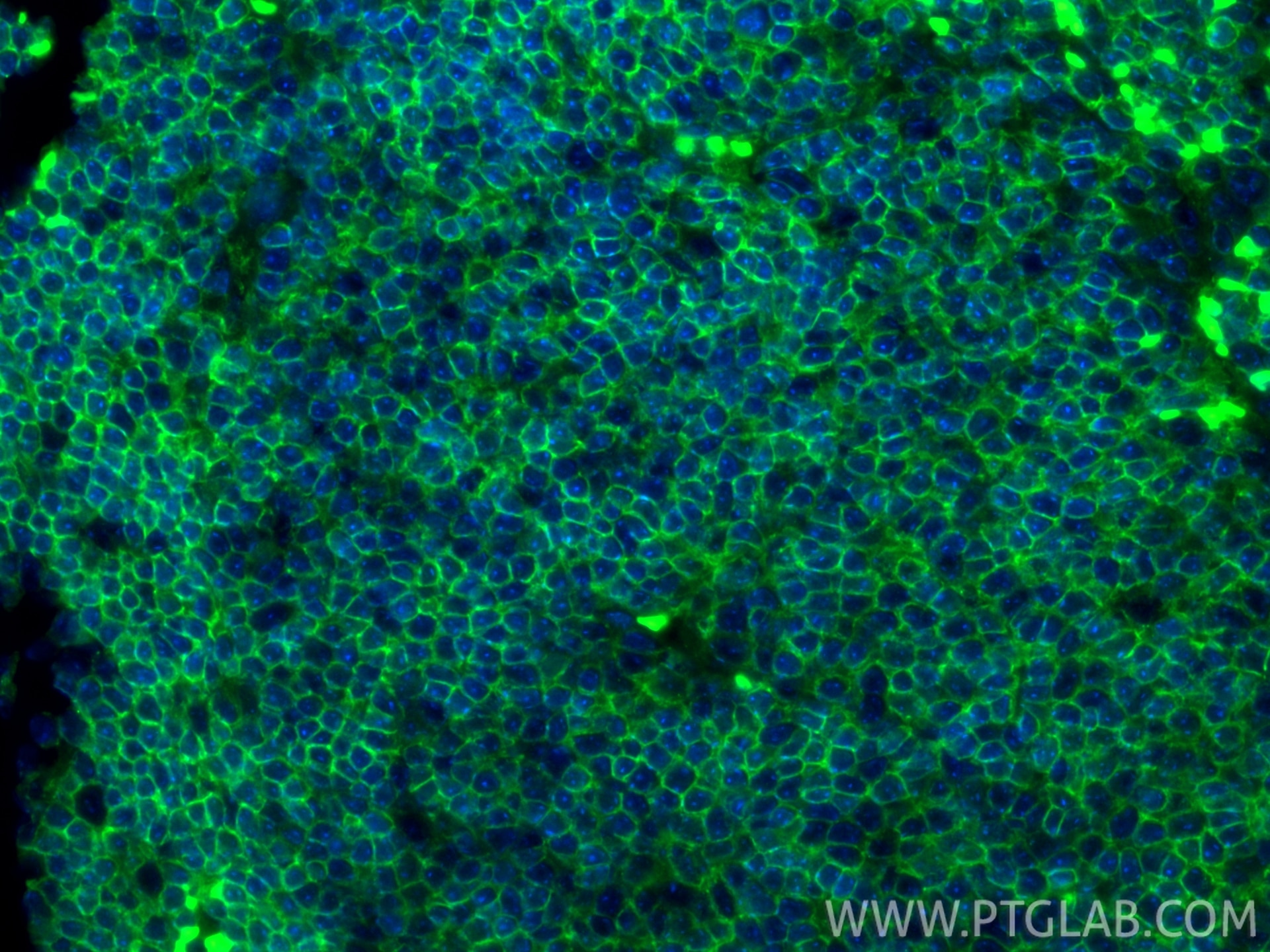 Immunofluorescent analysis of (4% PFA) fixed paraffin-embedded BALB/c mouse spleen tissue using CoraLite® Plus 488 CD45.2 antibody (CL488-84637, Clone: 241543F9 ) at dilution of 1:200. Heat mediated antigen retrieval with Tris-EDTA buffer (pH 9.0). Immunofluorescence (IF) / fluorescent staining of mouse spleen tissue using CoraLite® Plus 488-conjugated CD45.2 Recombinant m (CL488-84637)