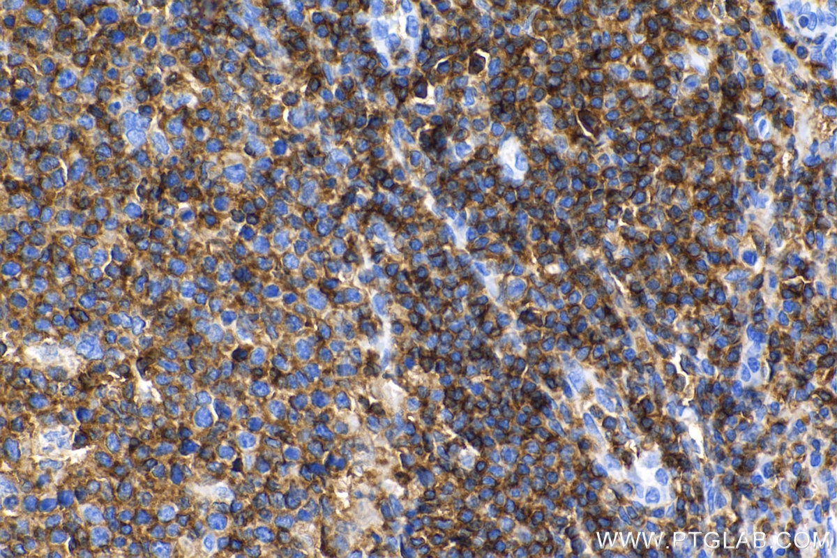 Immunohistochemistry (IHC) staining of human tonsil tissue using Anti-Human CD45 Rabbit Recombinant Antibody (98117-1-RR)