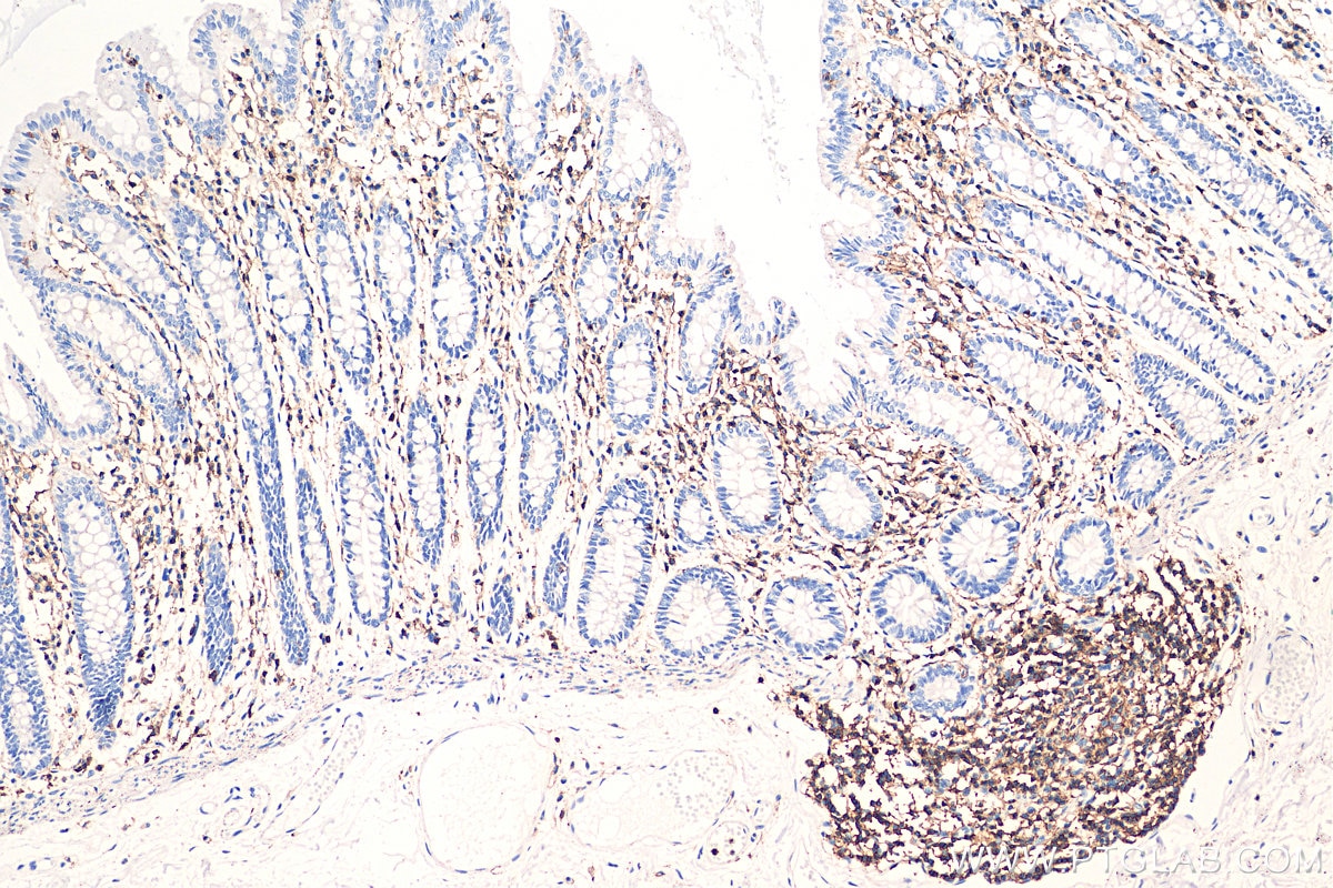 Immunohistochemistry (IHC) staining of human colon tissue using CD45 Polyclonal antibody (29914-1-AP)