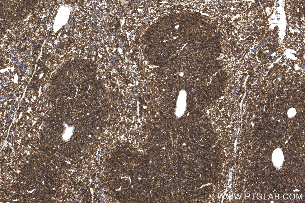 Immunohistochemistry (IHC) staining of mouse spleen tissue using CD45 Polyclonal antibody (31243-1-AP)