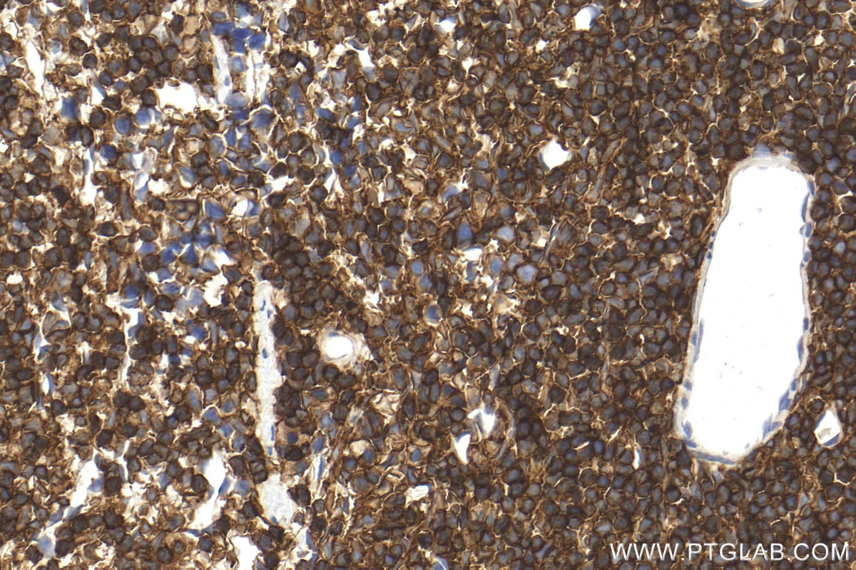 Immunohistochemistry (IHC) staining of mouse spleen tissue using CD45 Polyclonal antibody (31243-1-AP)