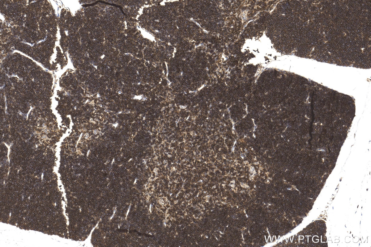 Immunohistochemistry (IHC) staining of mouse thymus tissue using CD45 Polyclonal antibody (31243-1-AP)