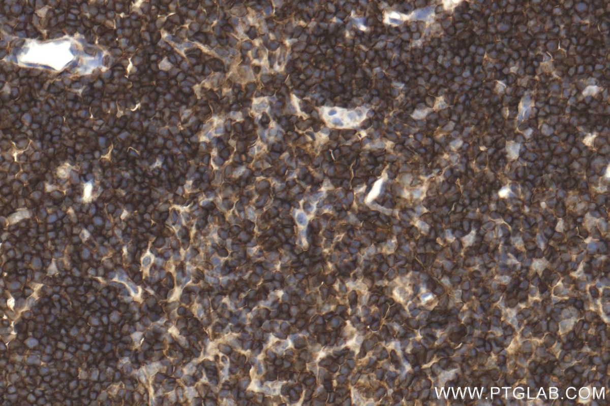 Immunohistochemistry (IHC) staining of mouse thymus tissue using CD45 Polyclonal antibody (31243-1-AP)