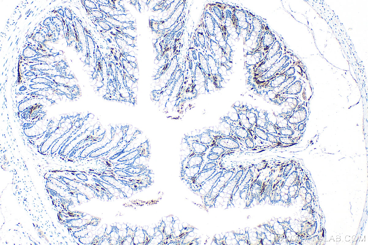 Immunohistochemistry (IHC) staining of mouse colon tissue using CD45 Polyclonal antibody (31243-1-AP)