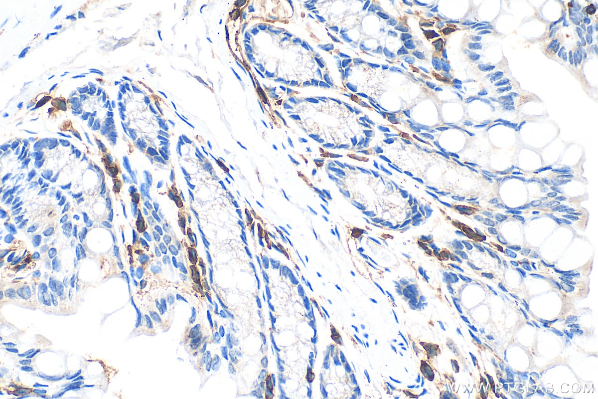 Immunohistochemistry (IHC) staining of mouse colon tissue using CD45 Polyclonal antibody (31243-1-AP)