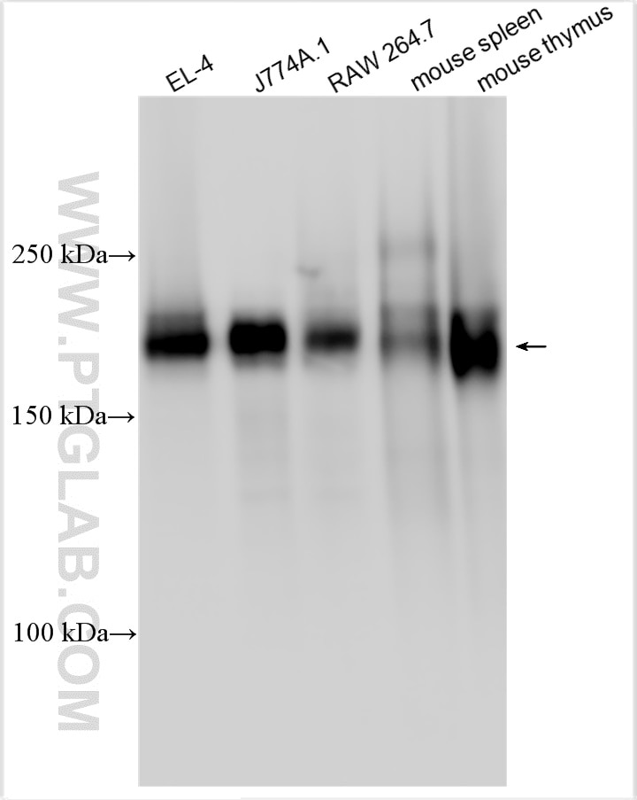 Western Blot (WB) analysis of various lysates using CD45 Polyclonal antibody (31243-1-AP)