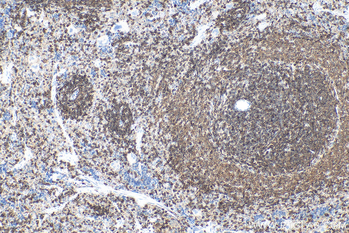 IHC staining of rat spleen using 33651-1-AP Immunohistochemistry (IHC) staining of rat spleen tissue using CD45 Polyclonal antibody (33651-1-AP)