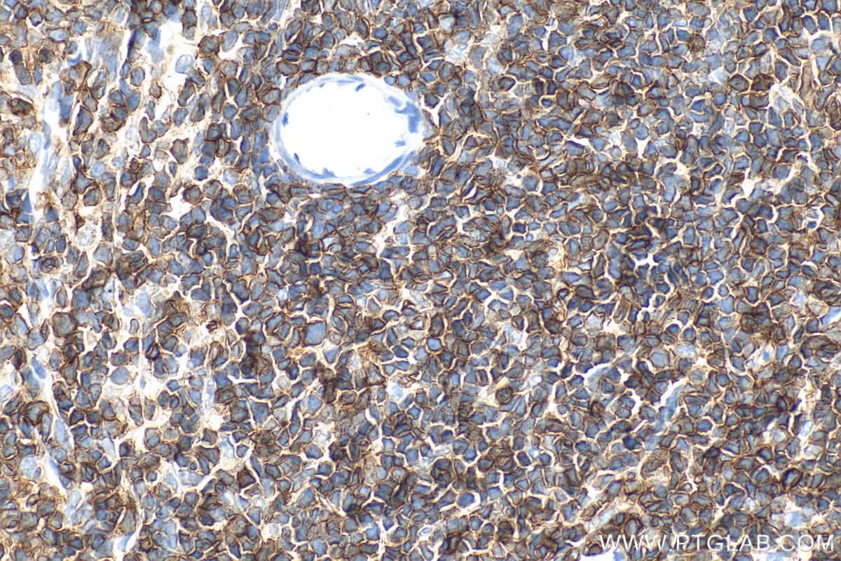 IHC staining of rat spleen using 33651-1-AP Immunohistochemistry (IHC) staining of rat spleen tissue using CD45 Polyclonal antibody (33651-1-AP)