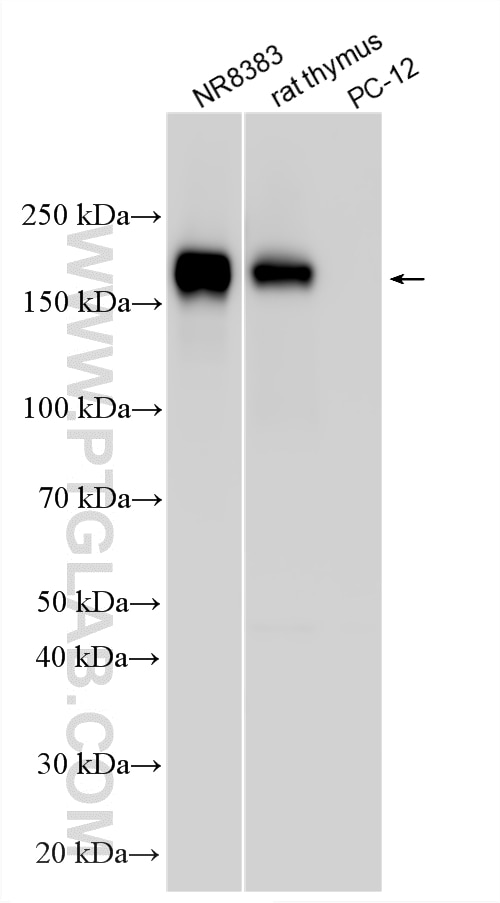 WB analysis using 33651-1-AP Western Blot (WB) analysis of various lysates using CD45 Polyclonal antibody (33651-1-AP)