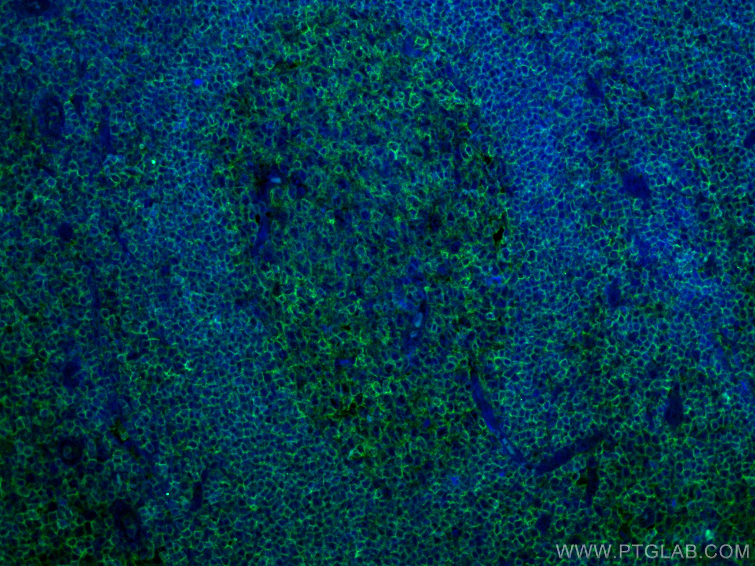 Immunofluorescence (IF) / fluorescent staining of human tonsillitis tissue using CD45 Monoclonal antibody (60287-1-Ig)
