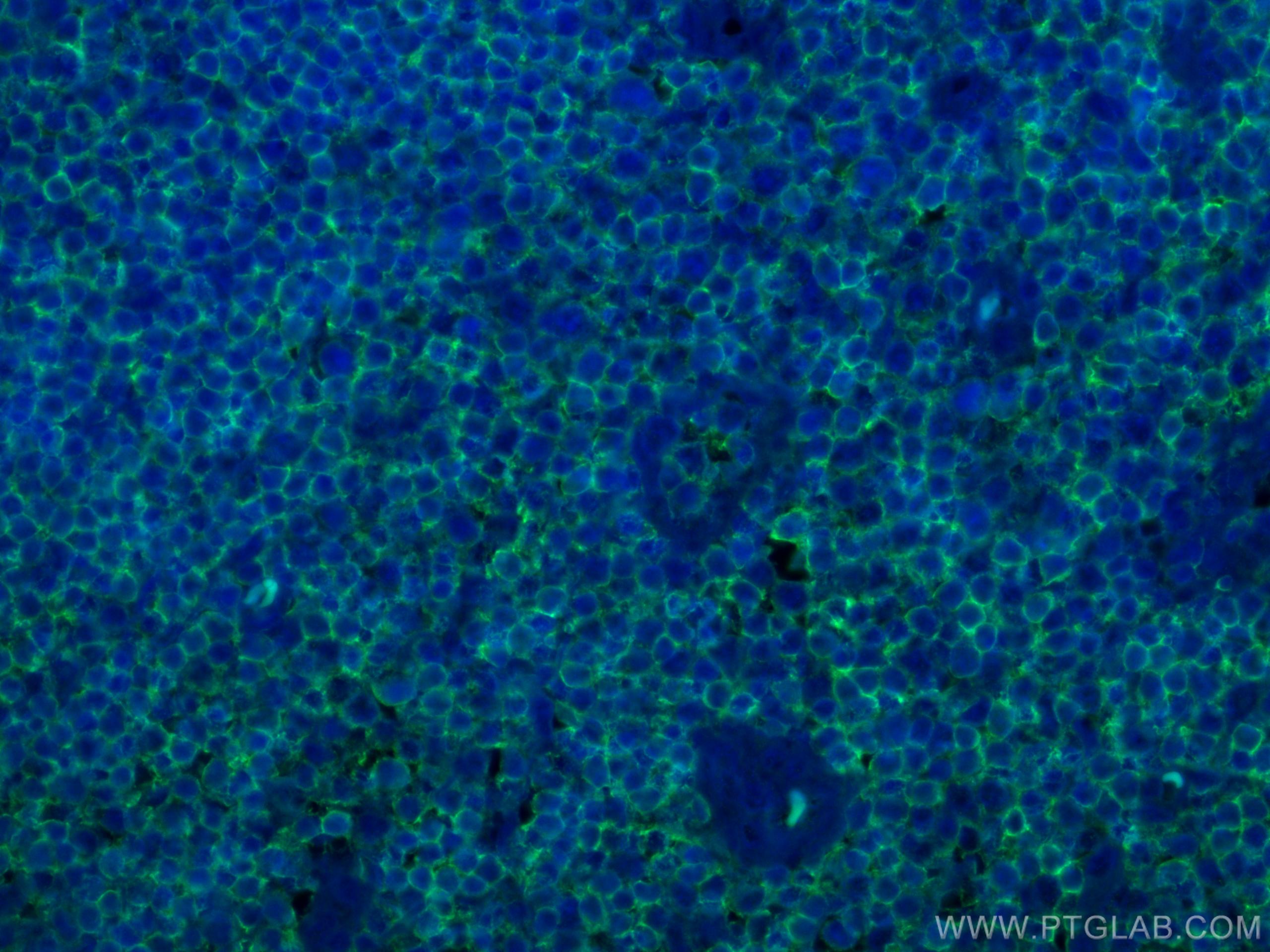 Immunofluorescence (IF) / fluorescent staining of human tonsillitis tissue using CD45 Monoclonal antibody (60287-1-Ig)