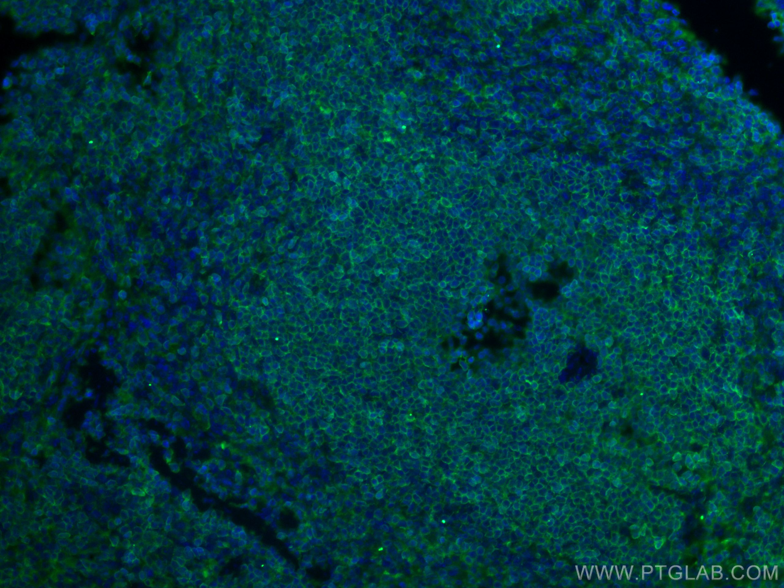 Immunofluorescence (IF) / fluorescent staining of mouse spleen tissue using CD45 Monoclonal antibody (60287-1-Ig)