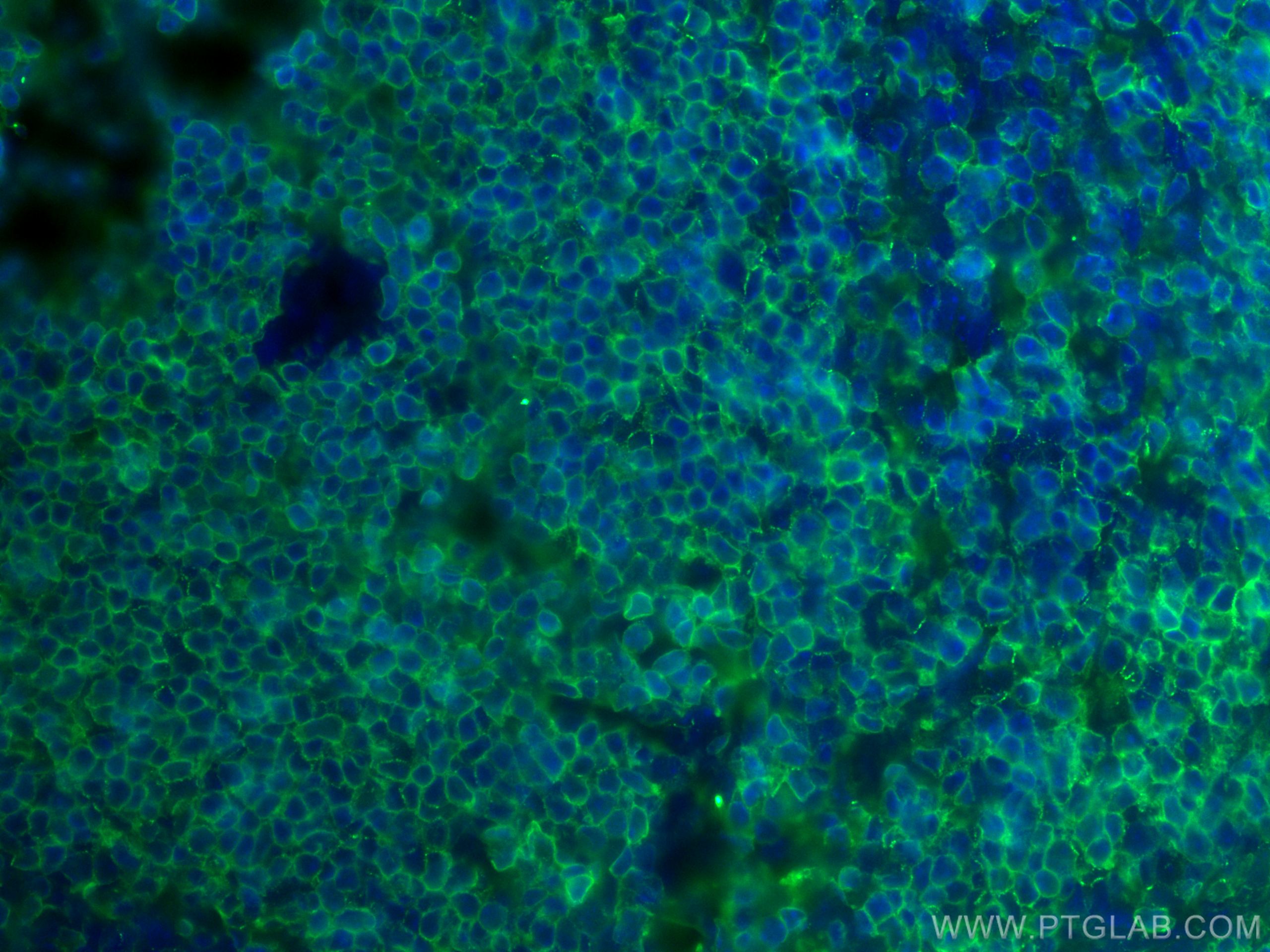 Immunofluorescence (IF) / fluorescent staining of mouse spleen tissue using CD45 Monoclonal antibody (60287-1-Ig)