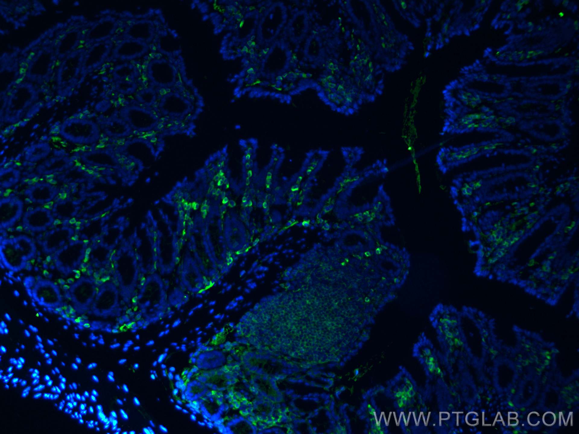 Immunofluorescence (IF) / fluorescent staining of mouse colon tissue using CD45 Monoclonal antibody (60287-1-Ig)